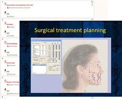 Figure 4: Interactive treatment planning
