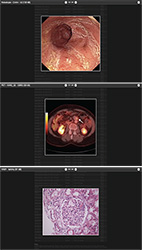 Figure 3. Results of diagnostic tests and biopsy are presented in a multimedia manner