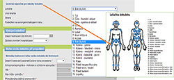 Figure 5. Localization of pressure ulcers (helping picture)